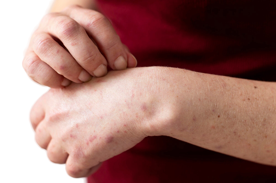 skin health banner